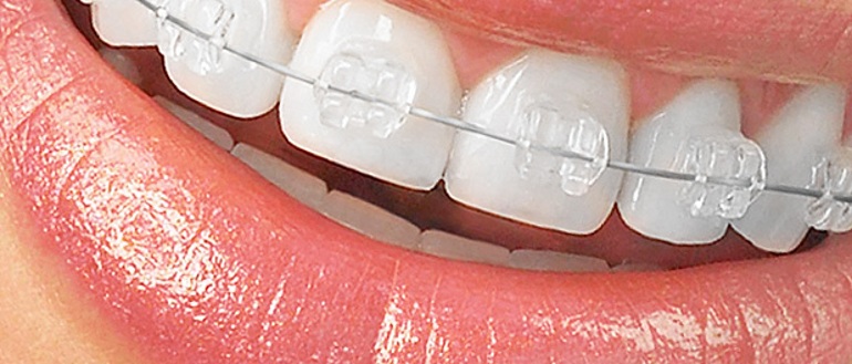 dentistas em juiz de fora, Ortodontia